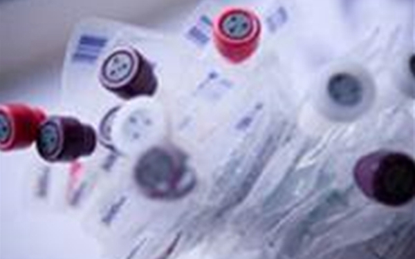 塑料粘結前等離子表面處理 塑料粘結前等離子表面處理